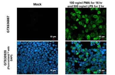 Anti-IL1 beta antibody [HL1421] used in Immunocytochemistry/ Immunofluorescence (ICC/IF). GTX636887